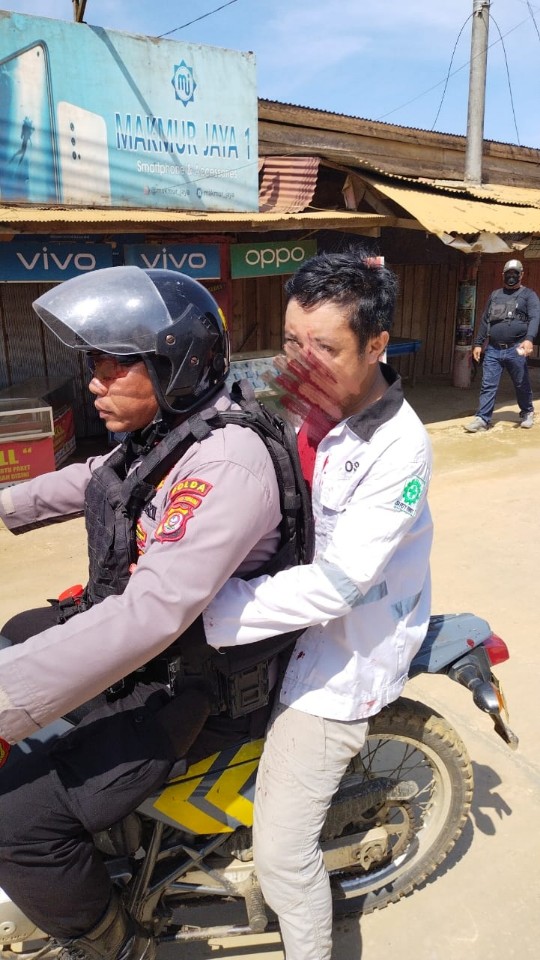 Adnan Dkk Dilaporkan ke Polisi, Diduga Aniaya Anggota Serikat Buruh Gunakan Kayu